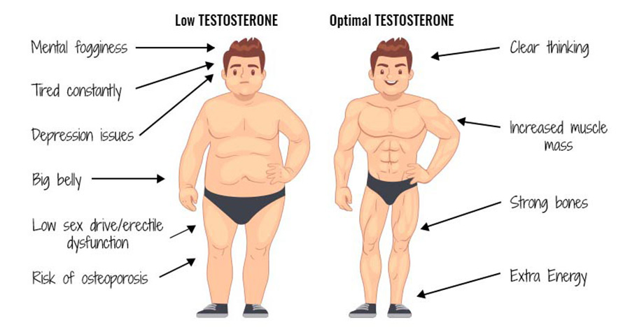 What is Steroid TRT?