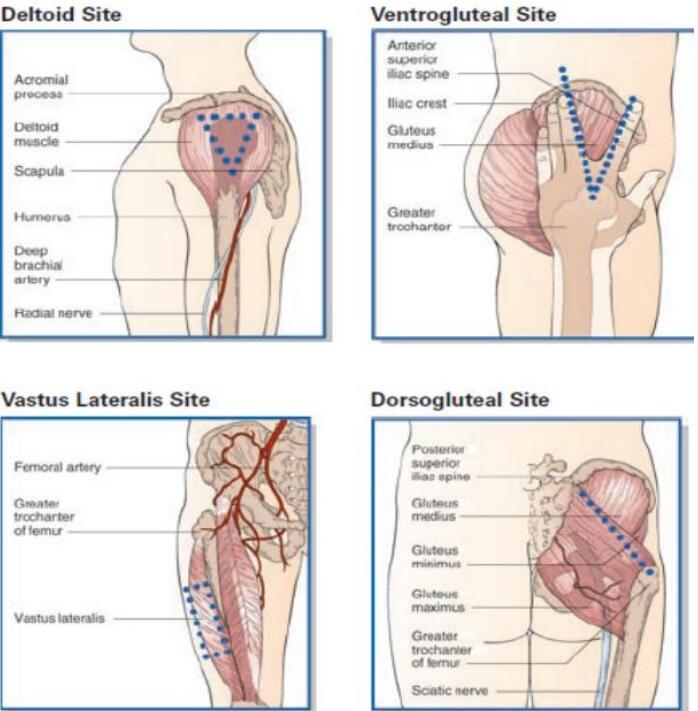 How to select the AAS injection site?