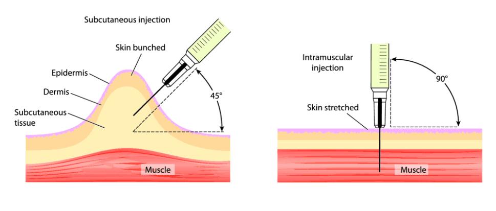 Differences between AAS and testosterone IM and SubQ injection